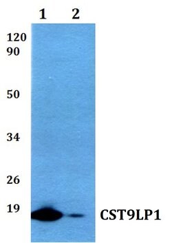 Invitrogen CST9LP1 Polyclonal Antibody 100 &mu;L; Unconjugated:Antibodies,