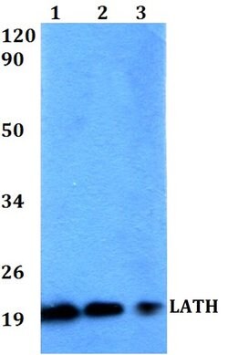 LATH Polyclonal Antibody:Antibodies, Polyclonal