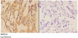 Invitrogen AANAT Polyclonal Antibody 100 &mu;L; Unconjugated:Antibodies,