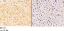 Invitrogen AANAT Polyclonal Antibody 100 &mu;L; Unconjugated:Antibodies,
