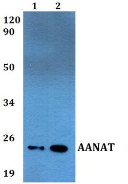 Invitrogen AANAT Polyclonal Antibody 100 &mu;L; Unconjugated:Antibodies,