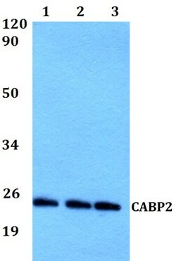 Invitrogen CABP2 Polyclonal Antibody 100 &mu;L; Unconjugated:Antibodies,