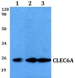 Invitrogen Dectin 2 Polyclonal Antibody 100 &mu;L; Unconjugated:Antibodies,