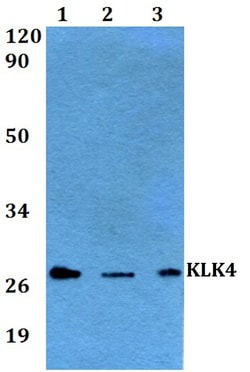 Invitrogen Kallikrein 4 Polyclonal Antibody 100 &mu;L; Unconjugated:Antibodies,