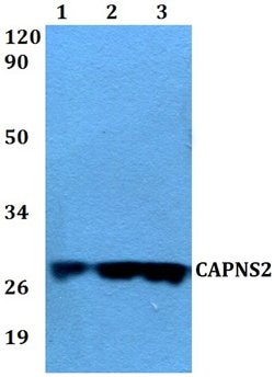 Invitrogen CAPNS2 Polyclonal Antibody 100 &mu;L; Unconjugated:Antibodies,