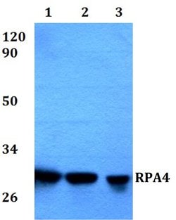 Invitrogen RPA4 Polyclonal Antibody 100 &mu;L; Unconjugated:Antibodies,