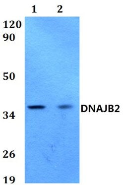 Invitrogen DNAJB2 Polyclonal Antibody 100 &mu;L; Unconjugated:Antibodies,