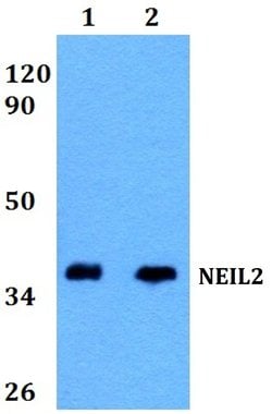 Invitrogen NEIL2 Polyclonal Antibody 100 &mu;L; Unconjugated:Antibodies,