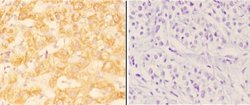 Invitrogen ABHD13 Polyclonal Antibody 100 &mu;L; Unconjugated:Antibodies,
