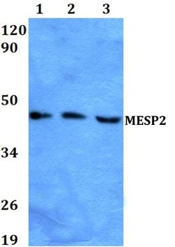 Invitrogen MESP2 Polyclonal Antibody 100 &mu;L; Unconjugated:Antibodies,