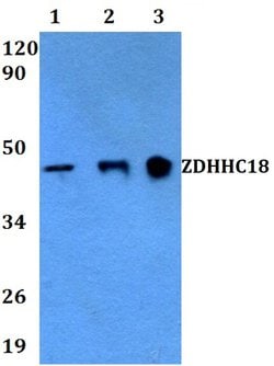Invitrogen ZDHHC18 Polyclonal Antibody 100 &mu;L; Unconjugated:Antibodies,