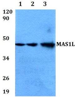 Invitrogen MAS1L Polyclonal Antibody 100 &mu;L | Buy Online | Invitrogen&trade; | Fisher Scientific