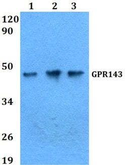 Invitrogen GPR143 Polyclonal Antibody 100 &mu;L | Buy Online | Invitrogen&trade; | Fisher Scientific