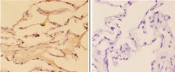 Invitrogen ABHD3 Polyclonal Antibody 100 &mu;L; Unconjugated:Antibodies,