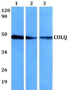 Invitrogen COLQ Polyclonal Antibody 100 &mu;L | Buy Online | Invitrogen&trade; | Fisher Scientific