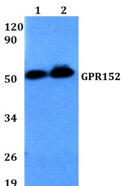 Invitrogen GPR152 Polyclonal Antibody 100 &mu;L; Unconjugated:Antibodies,
