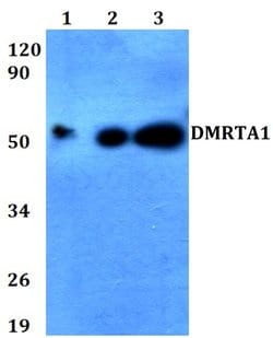 DMRTA1 Polyclonal Antibody:Antibodies, Polyclonal