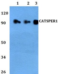 Invitrogen CATSPER1 Polyclonal Antibody 100 &mu;L; Unconjugated:Antibodies,