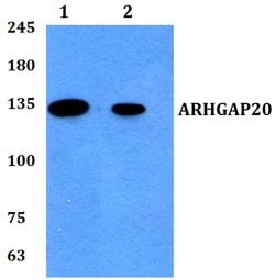 Invitrogen ARHGAP20 Polyclonal Antibody 100 &mu;L; Unconjugated:Antibodies,