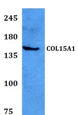 Invitrogen COL15A1 Polyclonal Antibody 100 &mu;L; Unconjugated:Antibodies,