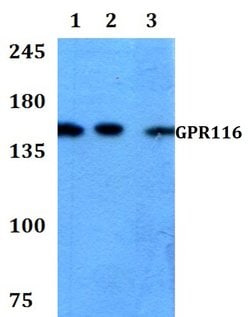 Invitrogen GPR116 Polyclonal Antibody 100 &mu;L | Buy Online | Invitrogen&trade; | Fisher Scientific