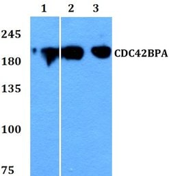 Invitrogen MRCK alpha Polyclonal Antibody 100 &mu;L; Unconjugated:Antibodies,