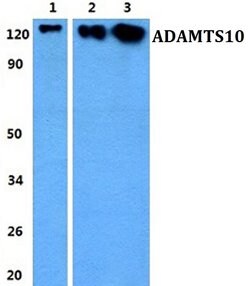Invitrogen ADAMTS10 Polyclonal Antibody 100 &mu;L | Buy Online | Invitrogen&trade; | Fisher Scientific
