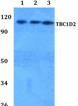 Invitrogen TBC1D2 Polyclonal Antibody 100 &mu;L; Unconjugated:Antibodies,