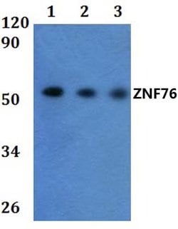 Invitrogen ZNF76 Polyclonal Antibody 100 &mu;L | Buy Online | Invitrogen&trade; | Fisher Scientific