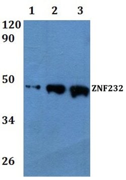 Invitrogen ZNF232 Polyclonal Antibody 100 &mu;L; Unconjugated:Antibodies,