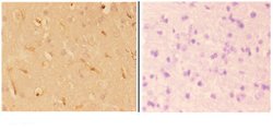 Invitrogen ABHD4 Polyclonal Antibody 100 &mu;L; Unconjugated:Antibodies,