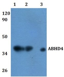 Invitrogen ABHD4 Polyclonal Antibody 100 &mu;L; Unconjugated:Antibodies,