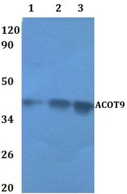 Invitrogen ACOT9 Polyclonal Antibody 100 &mu;L | Buy Online | Invitrogen&trade; | Fisher Scientific