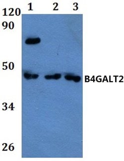 Invitrogen B4GALT2 Polyclonal Antibody 100 &mu;L; Unconjugated:Antibodies,