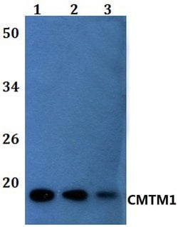 Invitrogen CMTM1 Polyclonal Antibody 100 &mu;L | Buy Online | Invitrogen&trade; | Fisher Scientific