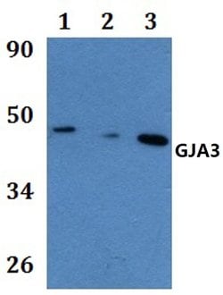 Invitrogen Connexin 46 Polyclonal Antibody 100 &mu;L | Buy Online | Invitrogen&trade; | Fisher Scientific