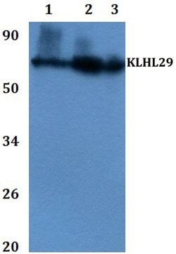 Invitrogen KLHL29 Polyclonal Antibody 100 &mu;L; Unconjugated:Antibodies,