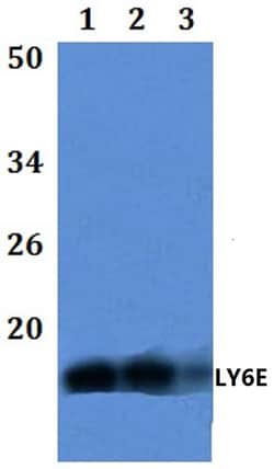 Invitrogen Ly-6E Polyclonal Antibody 100 &mu;L; Unconjugated:Antibodies,