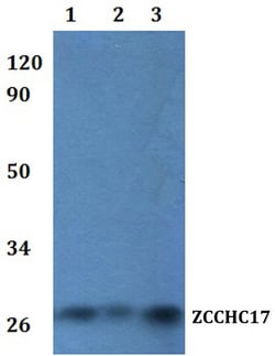 Invitrogen ZCCHC17 Polyclonal Antibody 100 &mu;L; Unconjugated:Antibodies,