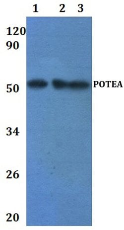 Invitrogen POTEA Polyclonal Antibody 100 &mu;L; Unconjugated:Antibodies,