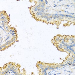 Invitrogen RNASE13 Polyclonal Antibody 100 &mu;L; Unconjugated:Antibodies,