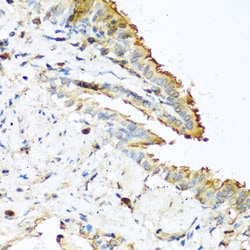 Invitrogen RNASE13 Polyclonal Antibody 100 &mu;L; Unconjugated:Antibodies,