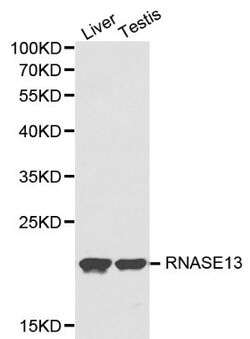 Invitrogen RNASE13 Polyclonal Antibody 100 &mu;L; Unconjugated:Antibodies,