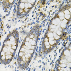 Invitrogen DEFB132 Polyclonal Antibody 100 &mu;L; Unconjugated:Antibodies,