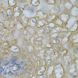 Invitrogen DEFB132 Polyclonal Antibody 100 &mu;L; Unconjugated:Antibodies,