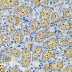 Invitrogen DEFB132 Polyclonal Antibody 100 &mu;L; Unconjugated:Antibodies,