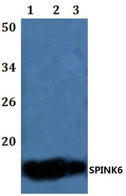 Invitrogen SPINK6 Polyclonal Antibody 100 &mu;L; Unconjugated:Antibodies,