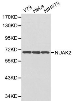 Invitrogen NUAK2 Polyclonal Antibody 100 &mu;L; Unconjugated:Antibodies,