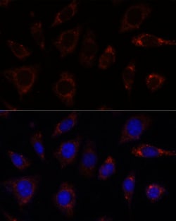Invitrogen TBRG4 Polyclonal Antibody 100 &mu;L | Buy Online | Invitrogen&trade; | Fisher Scientific