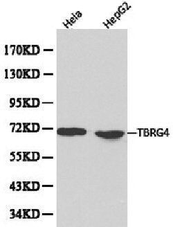 Invitrogen TBRG4 Polyclonal Antibody 100 &mu;L | Buy Online | Invitrogen&trade; | Fisher Scientific